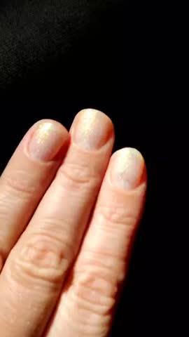 Solar Unicorn Skin™ - Customer Photo From Lilly